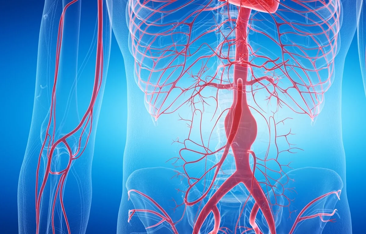  Aneurysma – příznaky a léčba