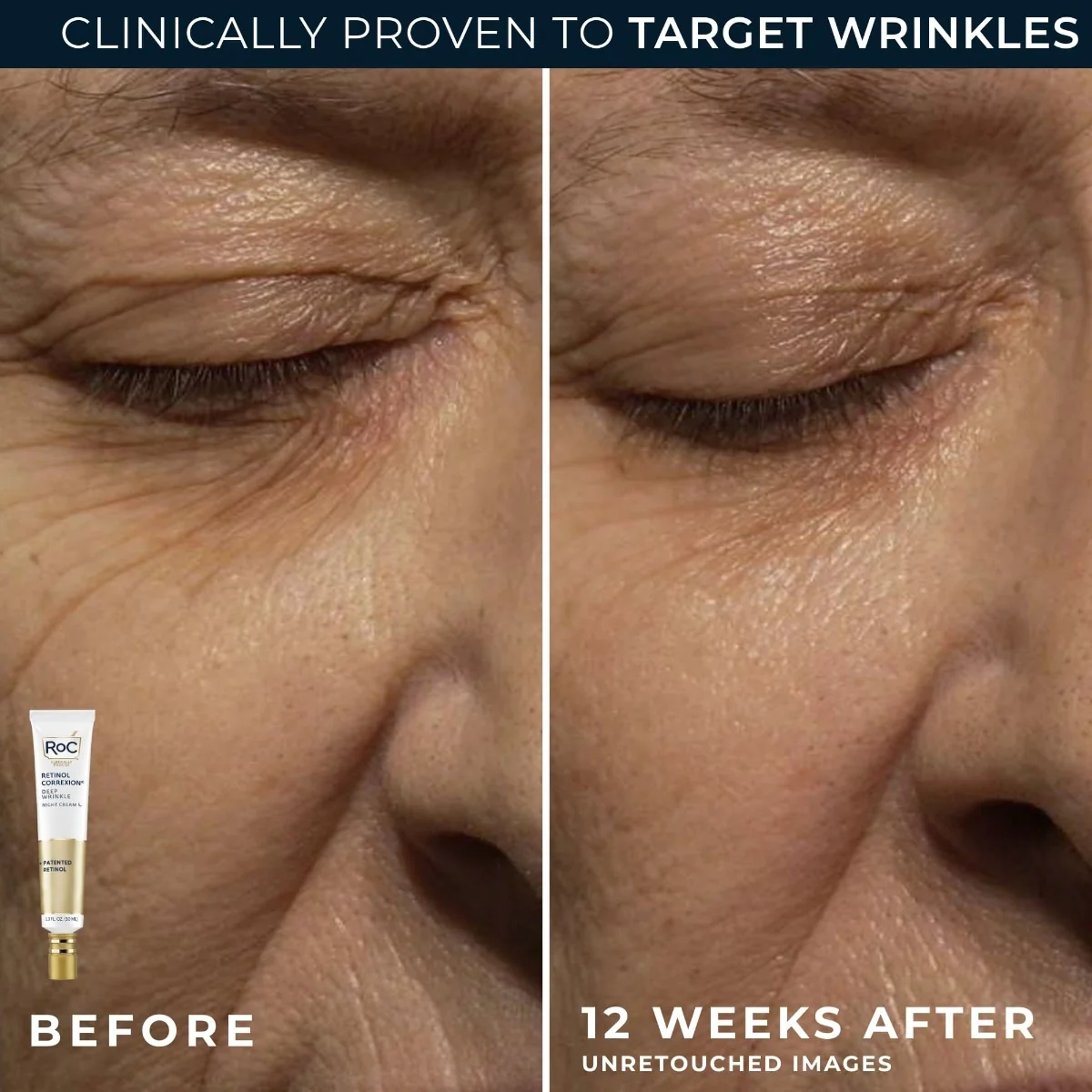 RoC Retinol Correxion Wrinkle Correct noční krém 30 ml