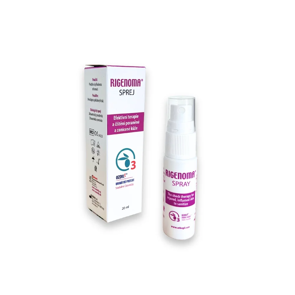 RIGENOMA bioaktivní sprej na rány s OZOILE 20 ml
