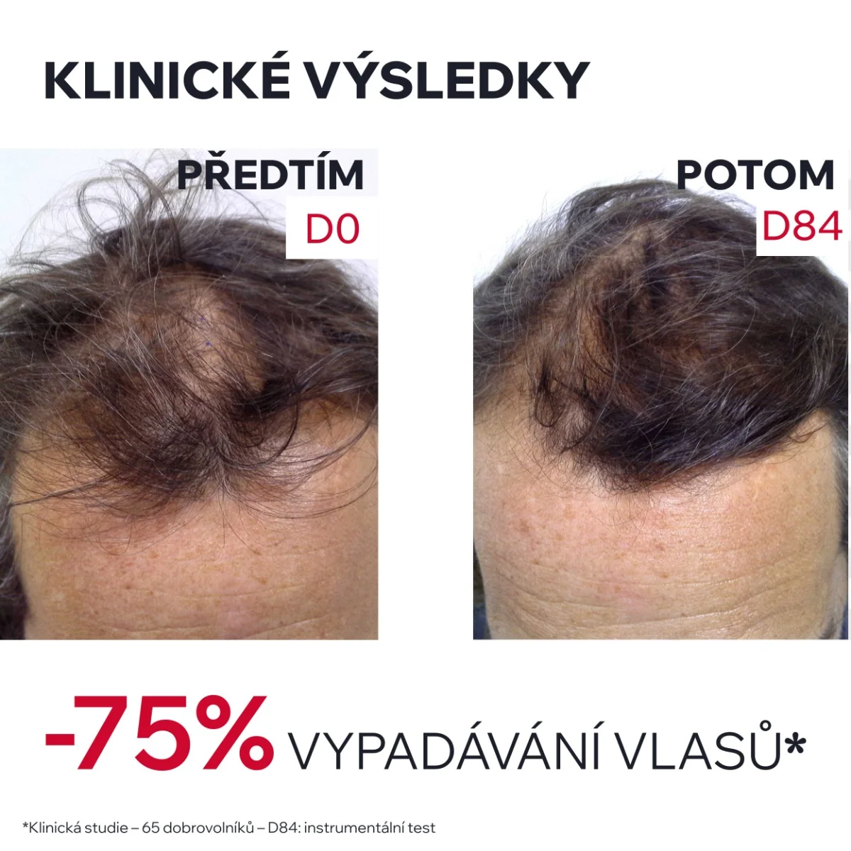 Uriage AP Hair Intenzivní sérum proti padání vlasů 100 ml