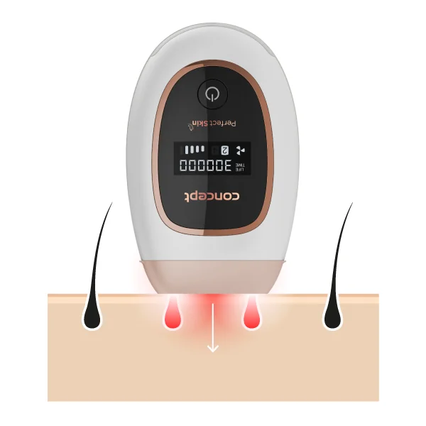 Concept Perfect Skin IL3020 IPL epilátor