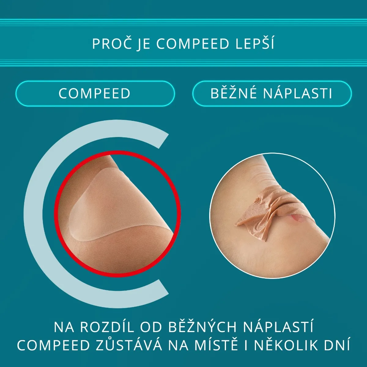 Compeed Náplast na puchýře střední 5 ks