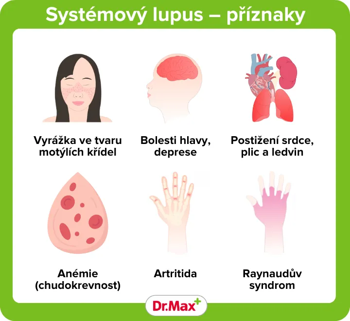 Lupus a příznaky nemoci
