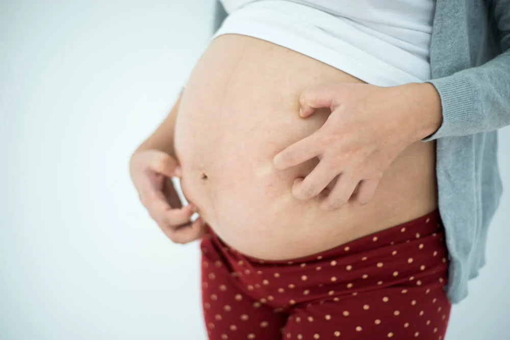 S postupujícím těhotenstvím se pokožka napíná, a způsobuje tak svědění kůže. S postupujícím těhotenstvím se pokožka napíná, a způsobuje tak svědění kůže.