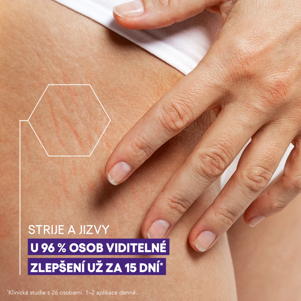 A-Derma Epiteliale A.H. DUO Massage masážní gel 40 ml