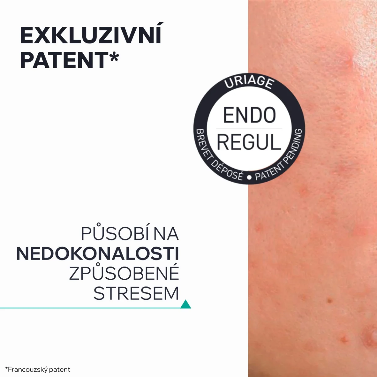 Uriage Hyséac Obnovující sérum proti nedokonalostem 30 ml