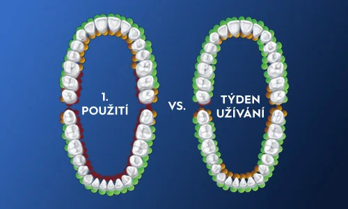 Oral-B 1. použití vs týden užívání Oral-B 1. použití vs týden užívání