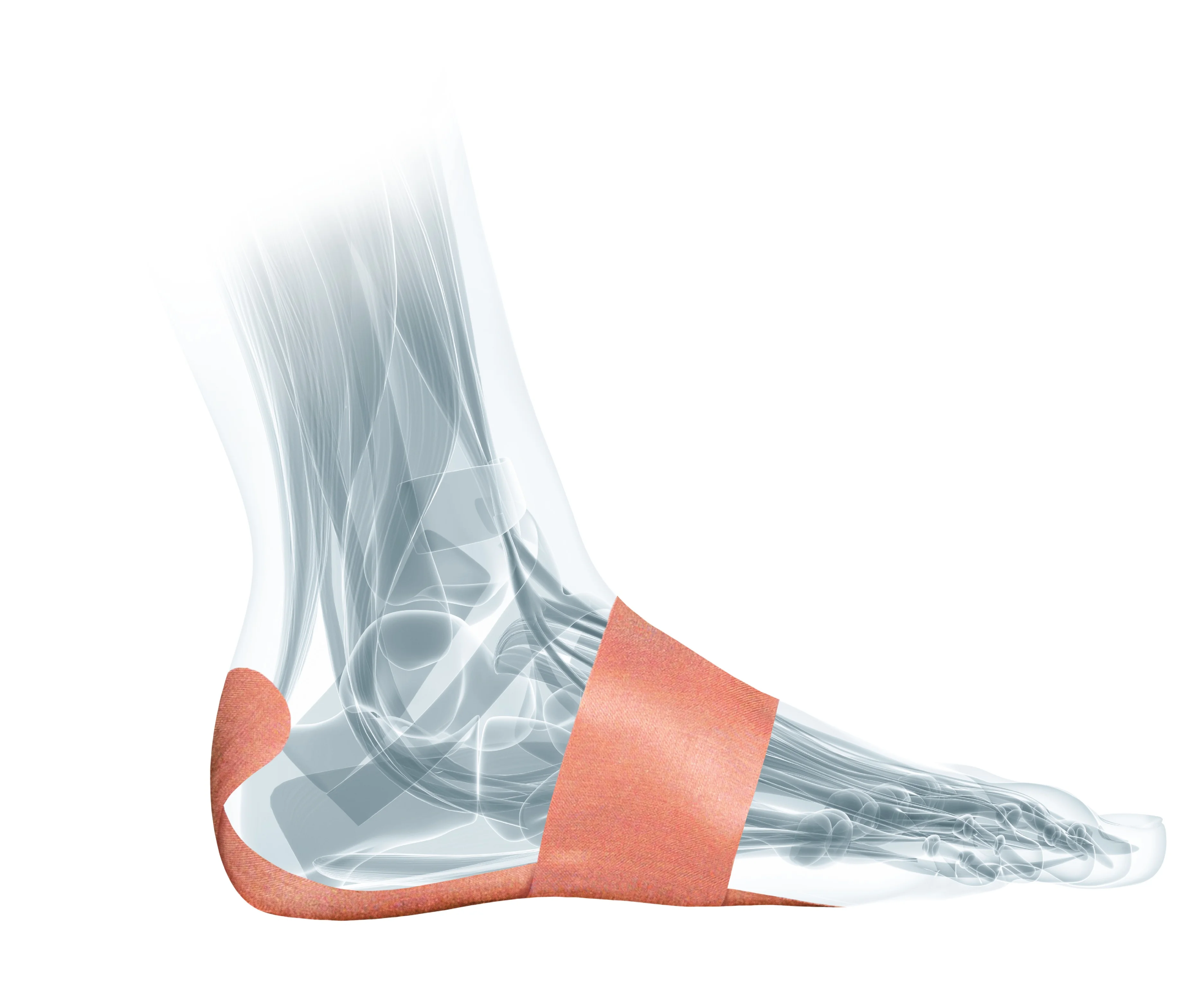 Mueller PFTape® Plantar Fasciitis Pain Relief System, tejp na podporu klenby