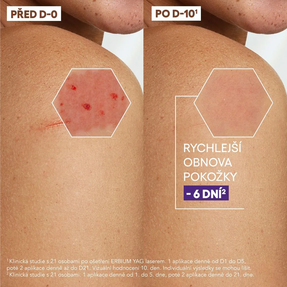 A-Derma Epithéliale Ultra Repair regenerační krém 40 ml