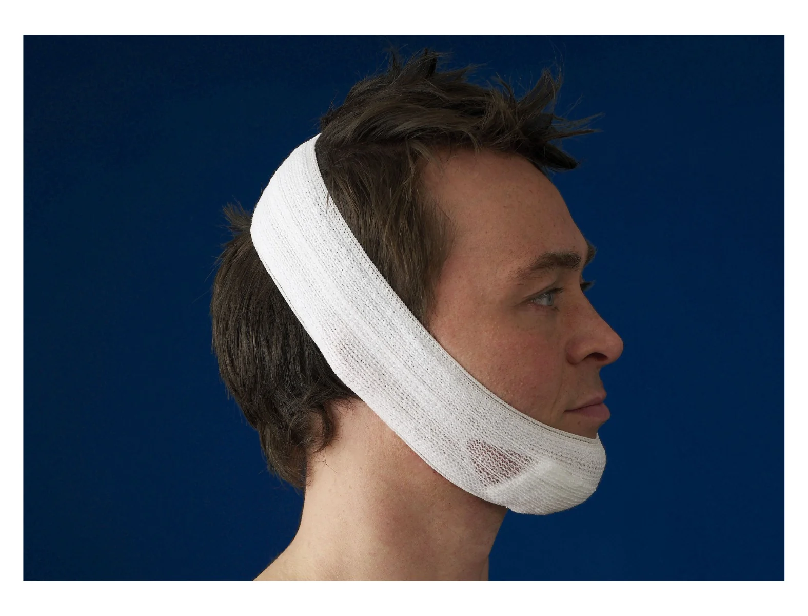 CareFix Headband vel. UNI elastická síťová čelenka 10 ks