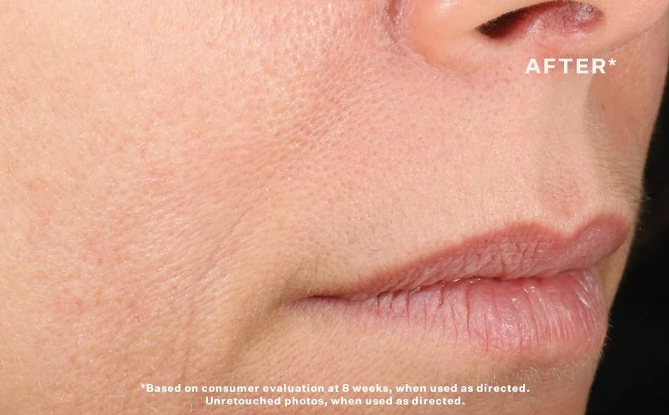 StriVectin Advanced Retinol Concentrated Serum pleťové sérum 30 ml