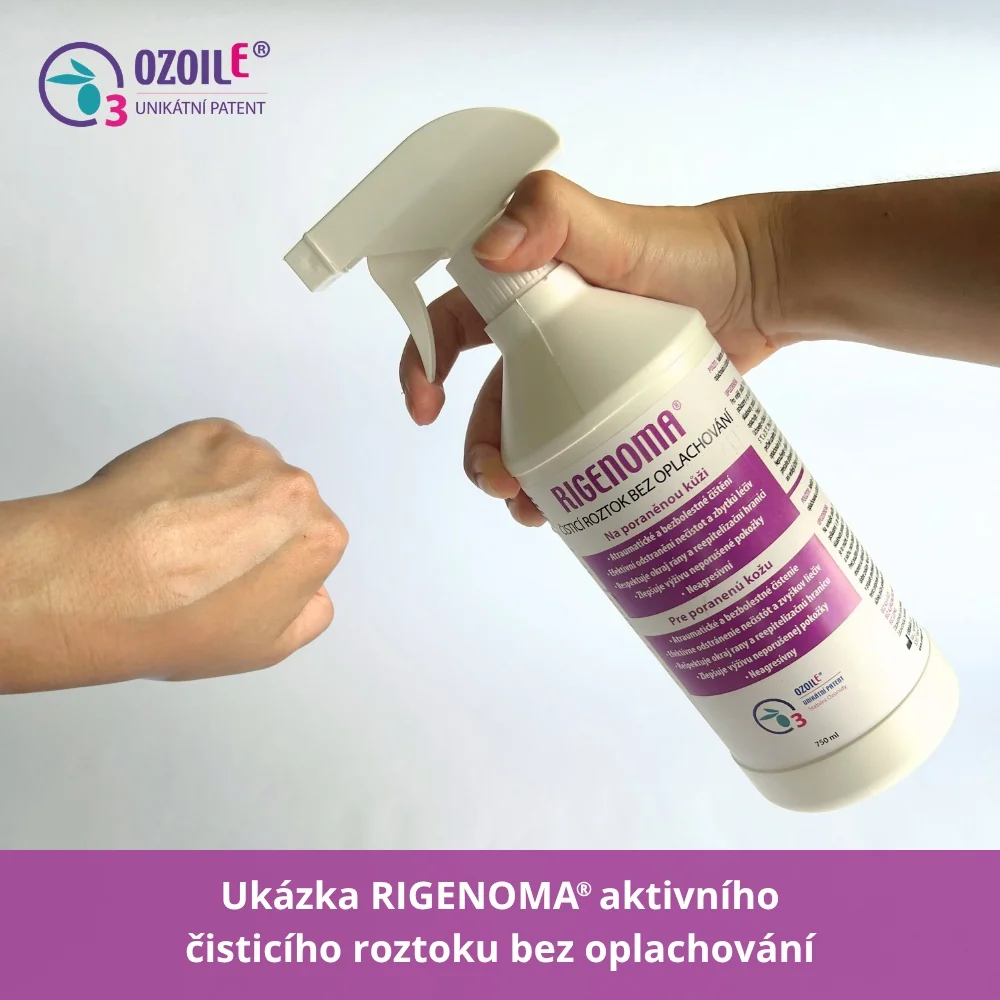 RIGENOMA aktivní čisticí roztok bez oplachování s OZOILE 750 ml
