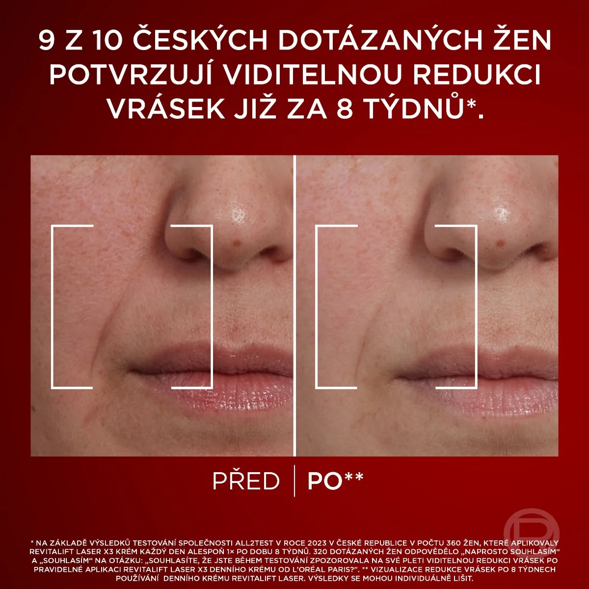 Loréal Paris Revitalift Laser denní intenzivní péče proti vráskám 50 ml
