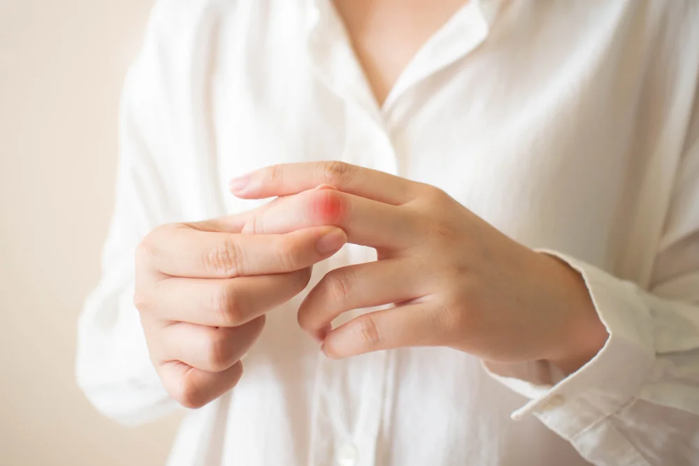 Raynaudův syndrom – proč blednou prsty a jak tomu předcházet?